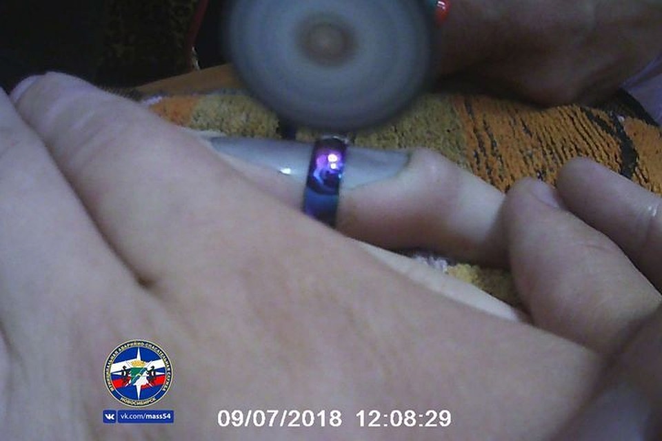 Юная девушка не смогла снять кольцо самостоятельно, пришлось воспользоваться мини дрелью со специальной насадкой. Фото: vk.com/mass54
