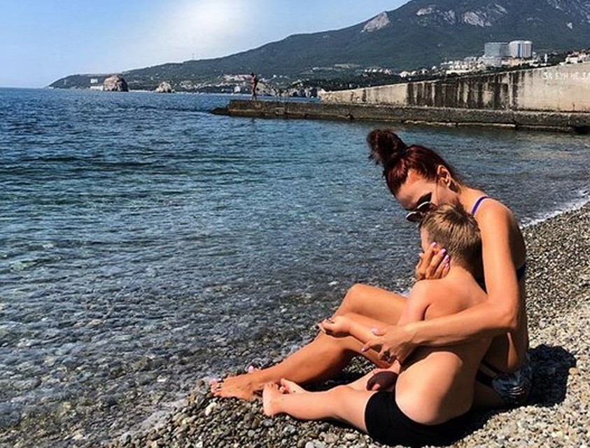 На следующий день раздражение немного спало. Фото: Instagram Эвелины Бледанс