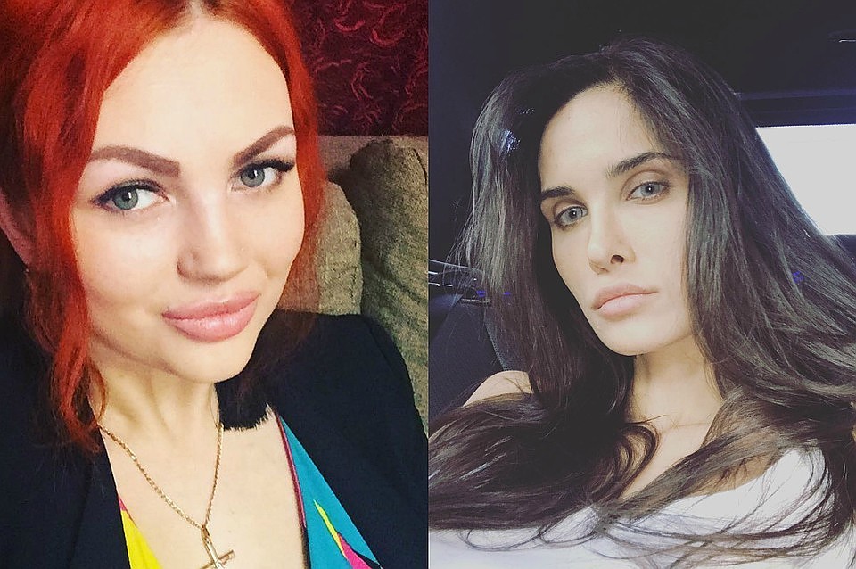 Узнав о трагедии Ирины (на фото слева), Алана Мамаева договорилась с хирургом из Берлина о бесплатной операции.