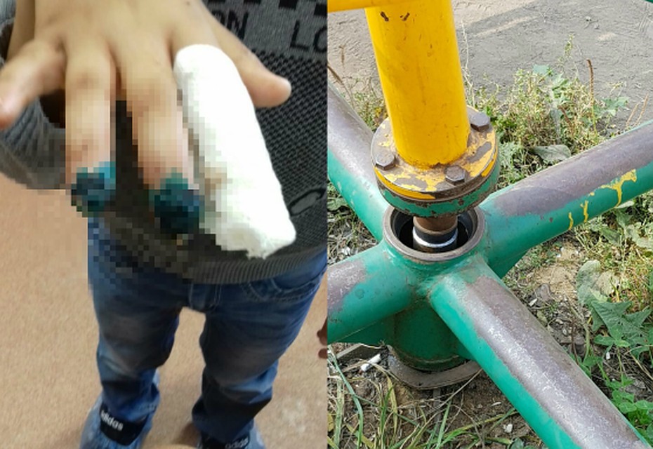 Мальчик ушел гулять вместе со своими друзьями, а через полчаса его уже принесли домой на руках