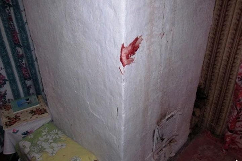 Ревнивый муж застал жену с другим мужчиной и ударил его ножом. Фото с сайта belta.by
