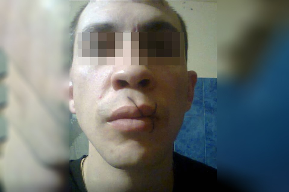 Осужденный зашил себе рот в знак протеста. Фото со страницы в Facebook Валерии Приходкиной