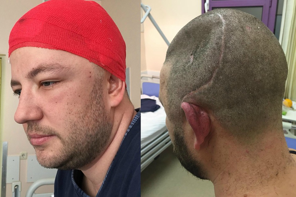 Павел только учится жить заново, однако последствия тяжелейшей травмы продолжают давать о себе знать.