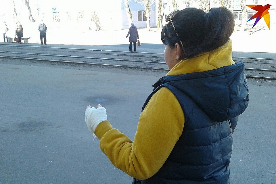 У Маши перевязана рука, а на носу три шва. Врачи обещают, что нос заживет "ювелирно".