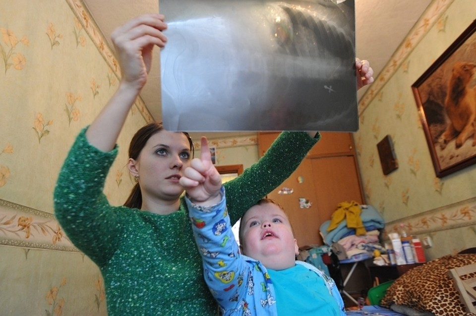 "Тихую" пневмонию нельзя услышать, но ее показывает рентген.