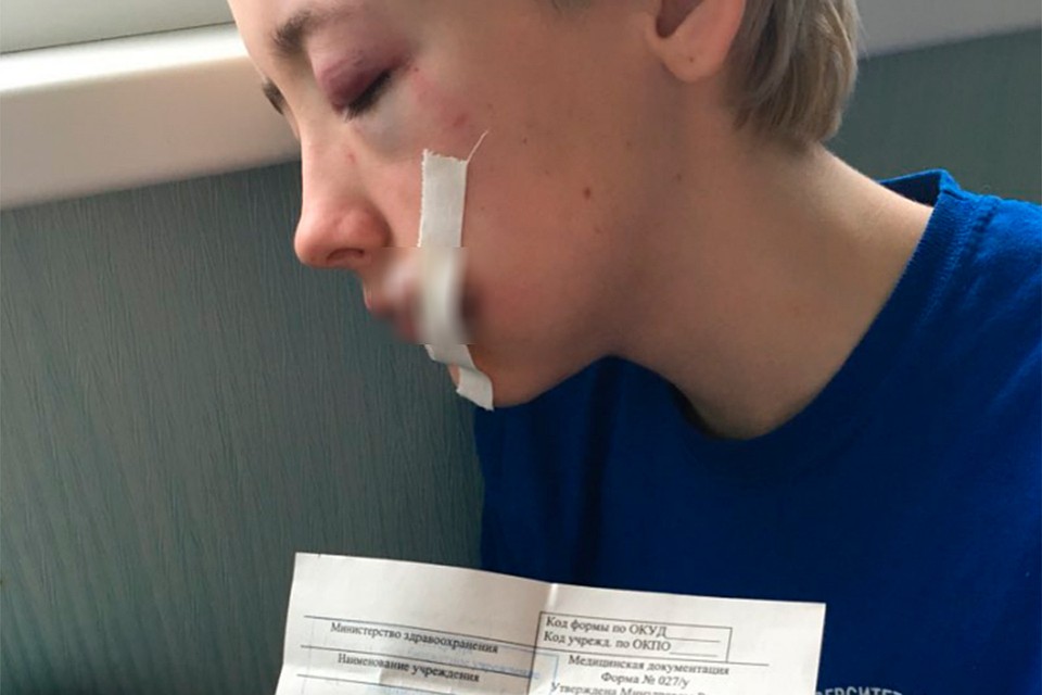 Екатерина С. пострадала сильнее остальных.
