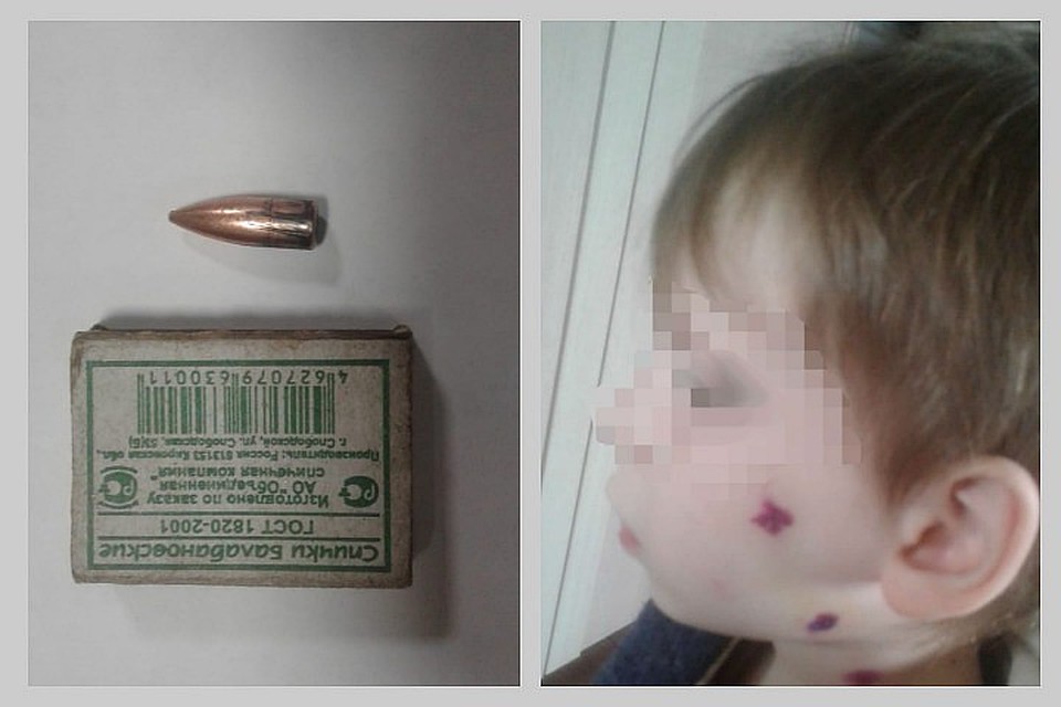 Стрелка, ранившего из оружия 6-летнего ребенка в новогоднюю ночь, ищет полиция. Фото: предоставлено семьей ребенка.