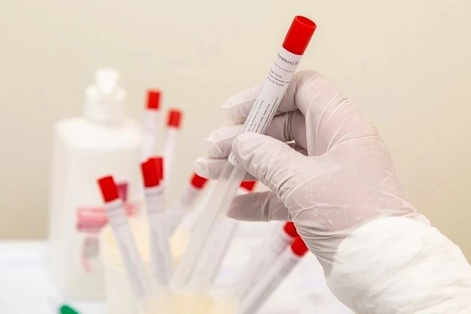 Общее число заболевших в стране сейчас составляет 65872 человек