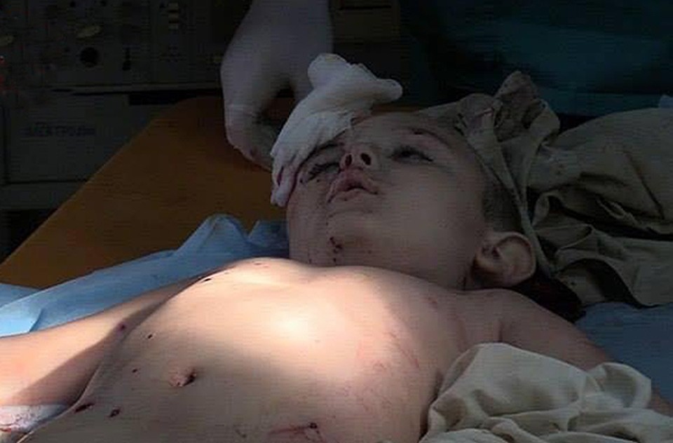 Этого мальчика убило минометной миной выпущенной с горы Карачун занятой ВСУ, в самые последние дни осады Славянска