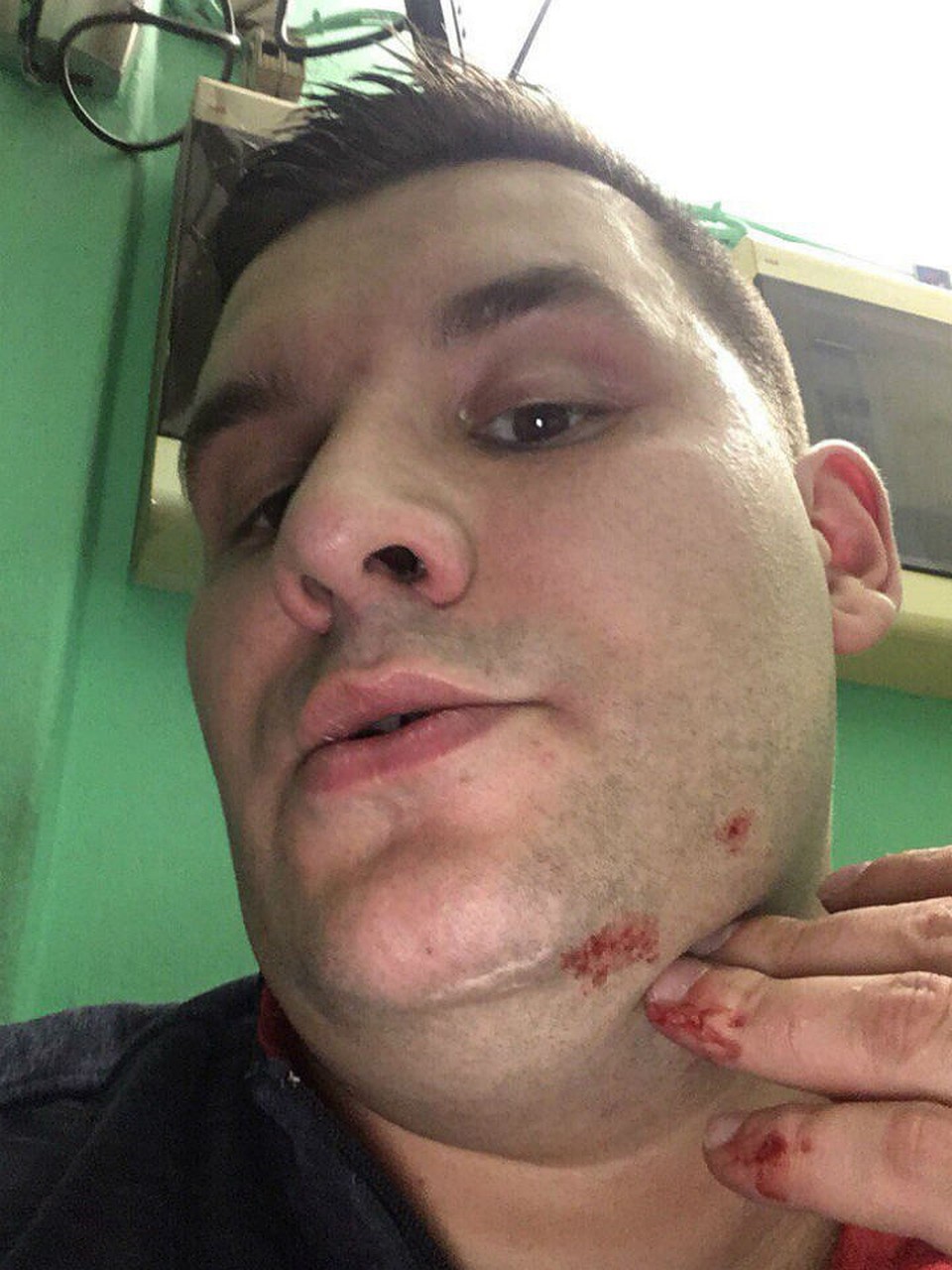 Александр Виноградов получил несколько ушибов и ссадин. Фото: СОЦСЕТИ