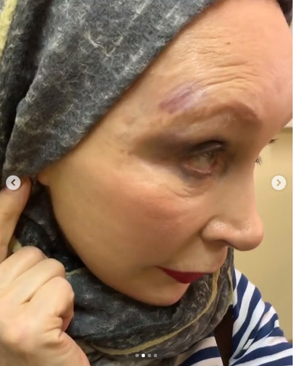 Актриса рассказала, что после удара у нее начали шататься зубы. Фото: кадр видео.