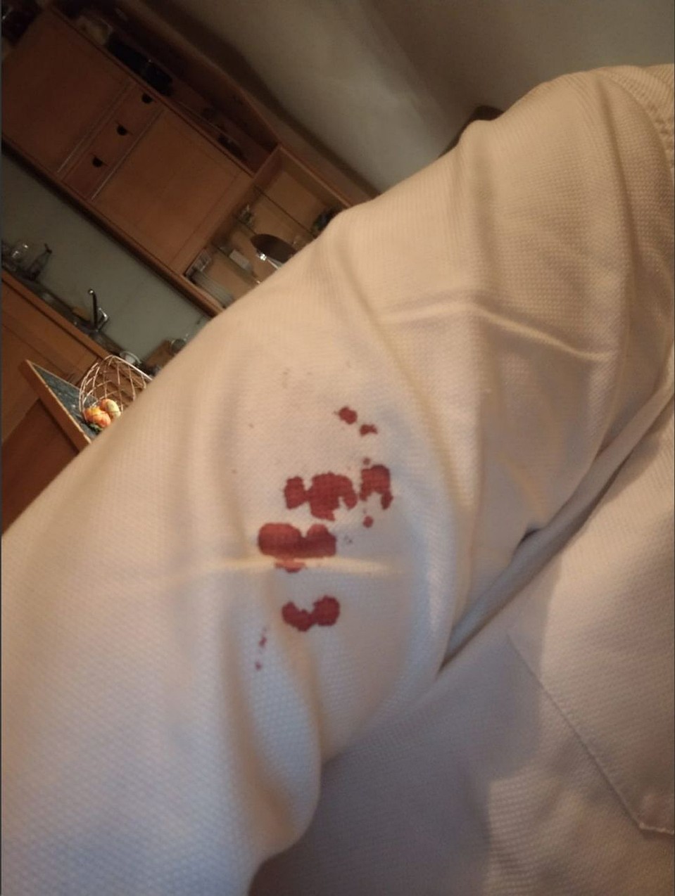Вадима Дерксена боевики ранили "розочкой" в руку. Фото: facebook.com