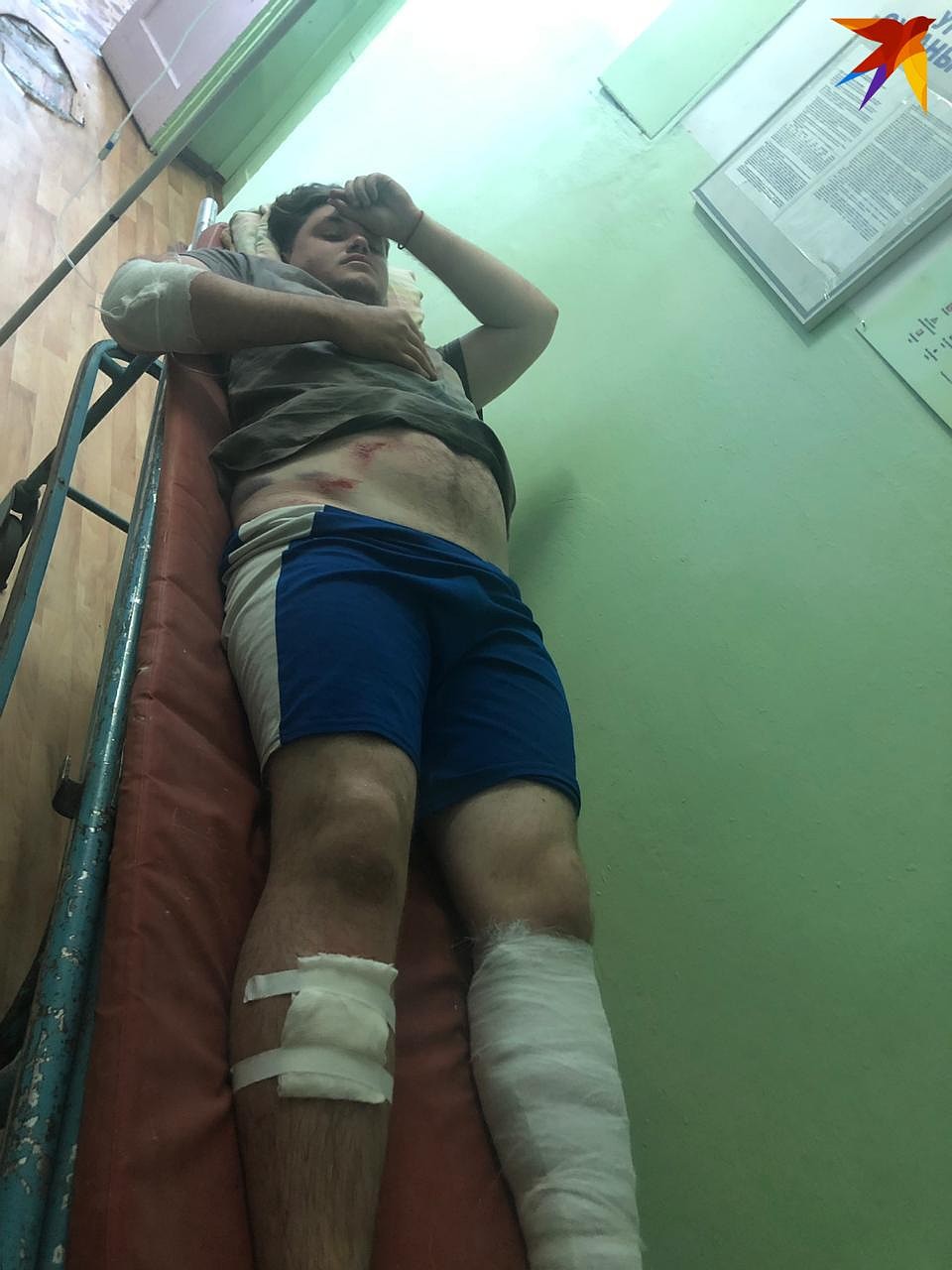 Пострадавший Влад Коваленко в больнице. Фото: предоставлено участниками аварии