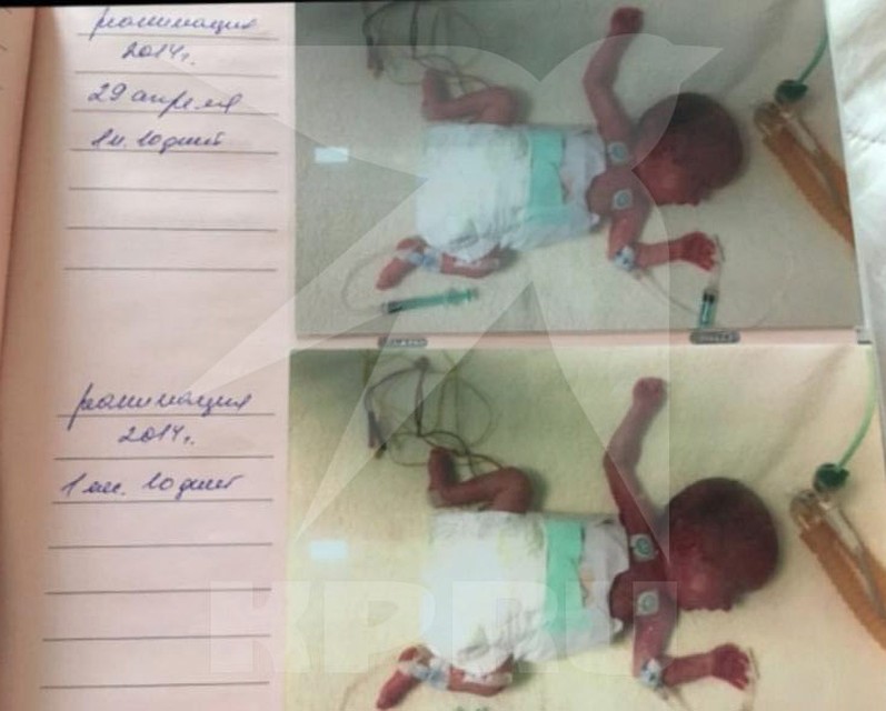 Саша родилась недоношенной в марте 2014 года. Фото: из архива семьи