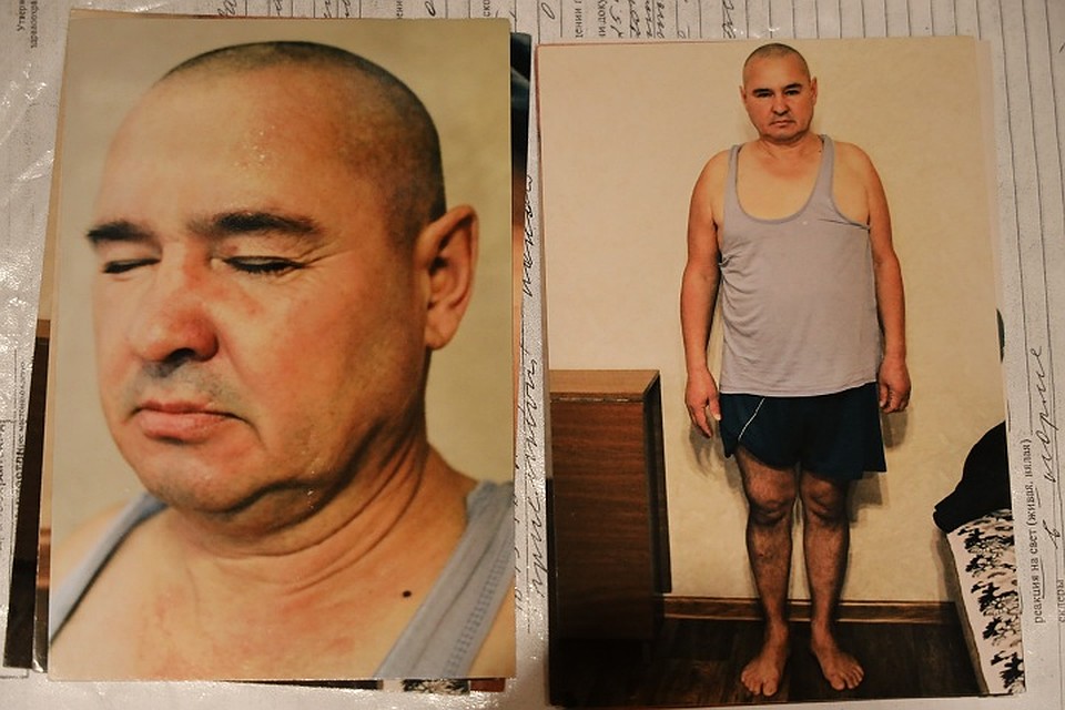 На следующий день после посещения участка Рамиль Музафаров пошел в травмпункт