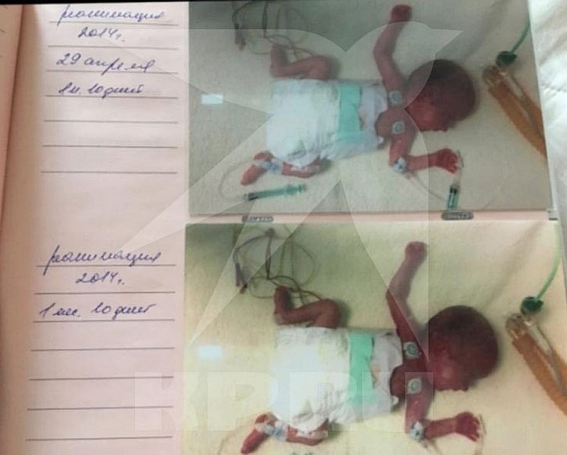 Саша родилась недоношенной в марте 2014 года. Фото: из архива семьи