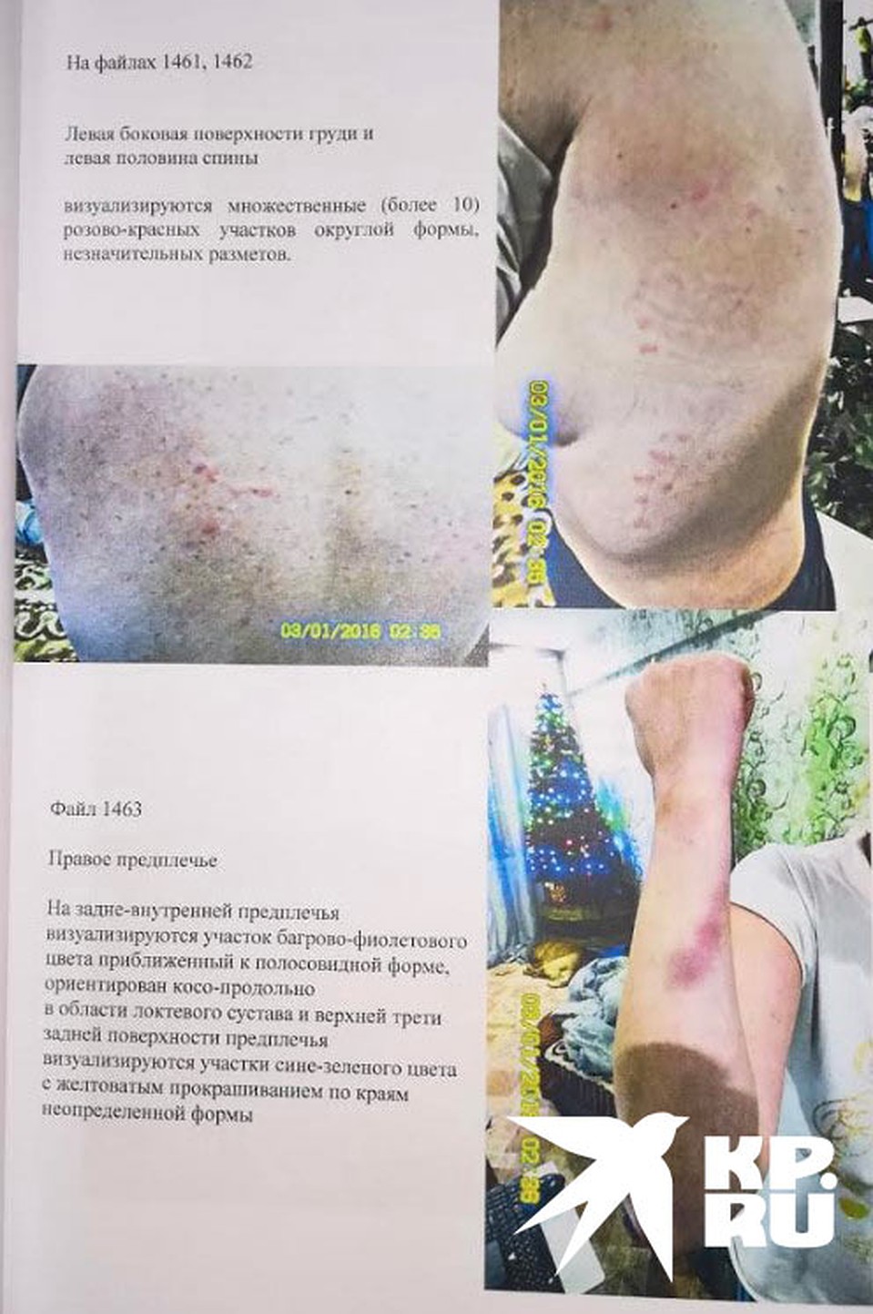 Фотофиксация побоев, снимки из уголовного дела.