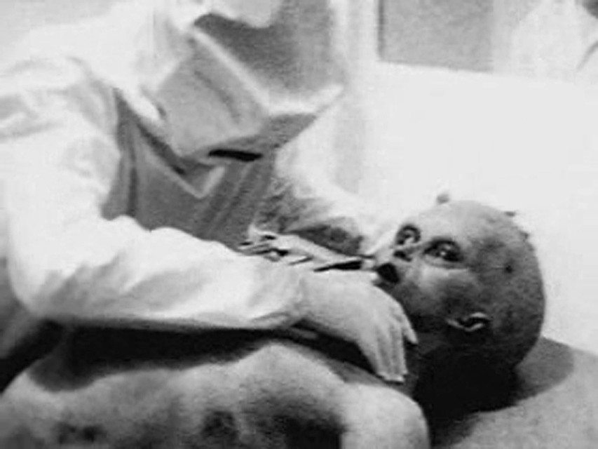 Есть версия, что американцы вскрывали инопланетян, якобы погибших в 1947 году в Розуэлле: кадр из фильма, запечатлевшего вскрытие