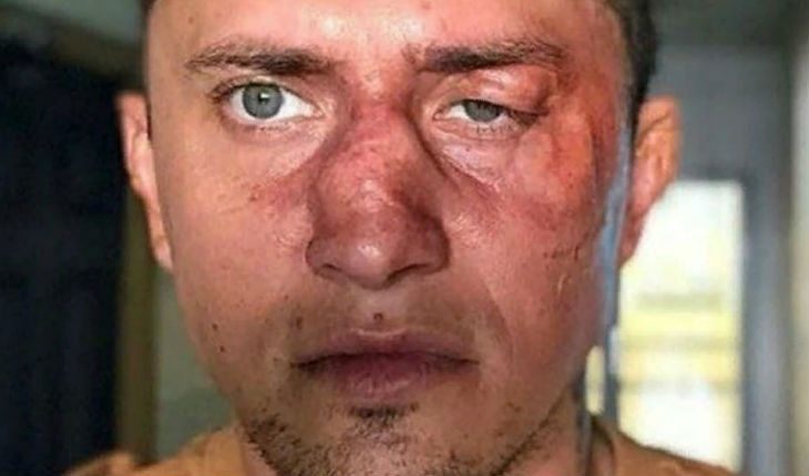 Состояние Павла Прилучного: кто на самом деле изувечил звезду сериала «Мажор»